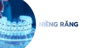 Niềng răng - Công Ty TNHH Dịch Vụ Nha Khoa Quốc Tế Smilux Dental